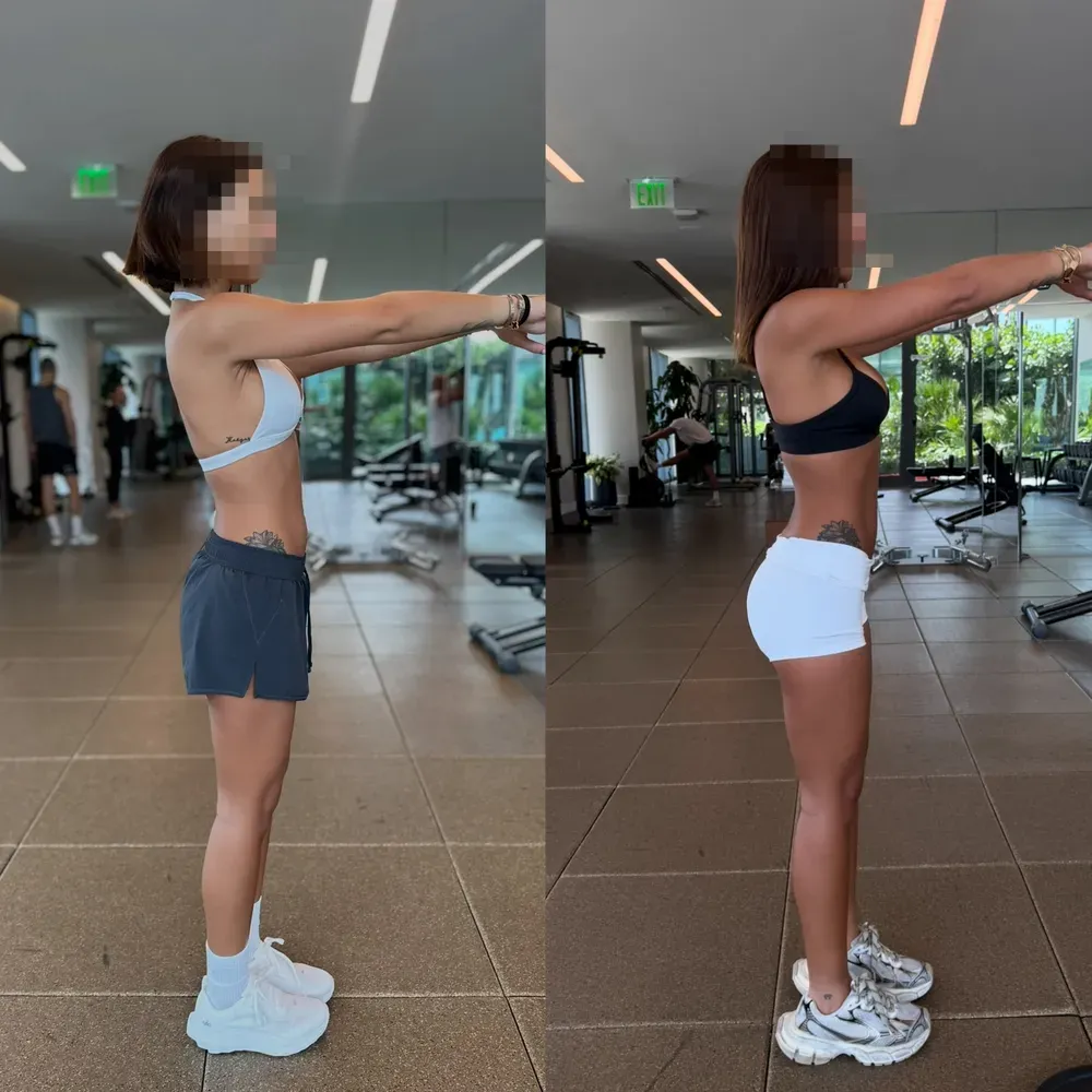 Clienta de Eire antes y después, de perfil en el gimnasio